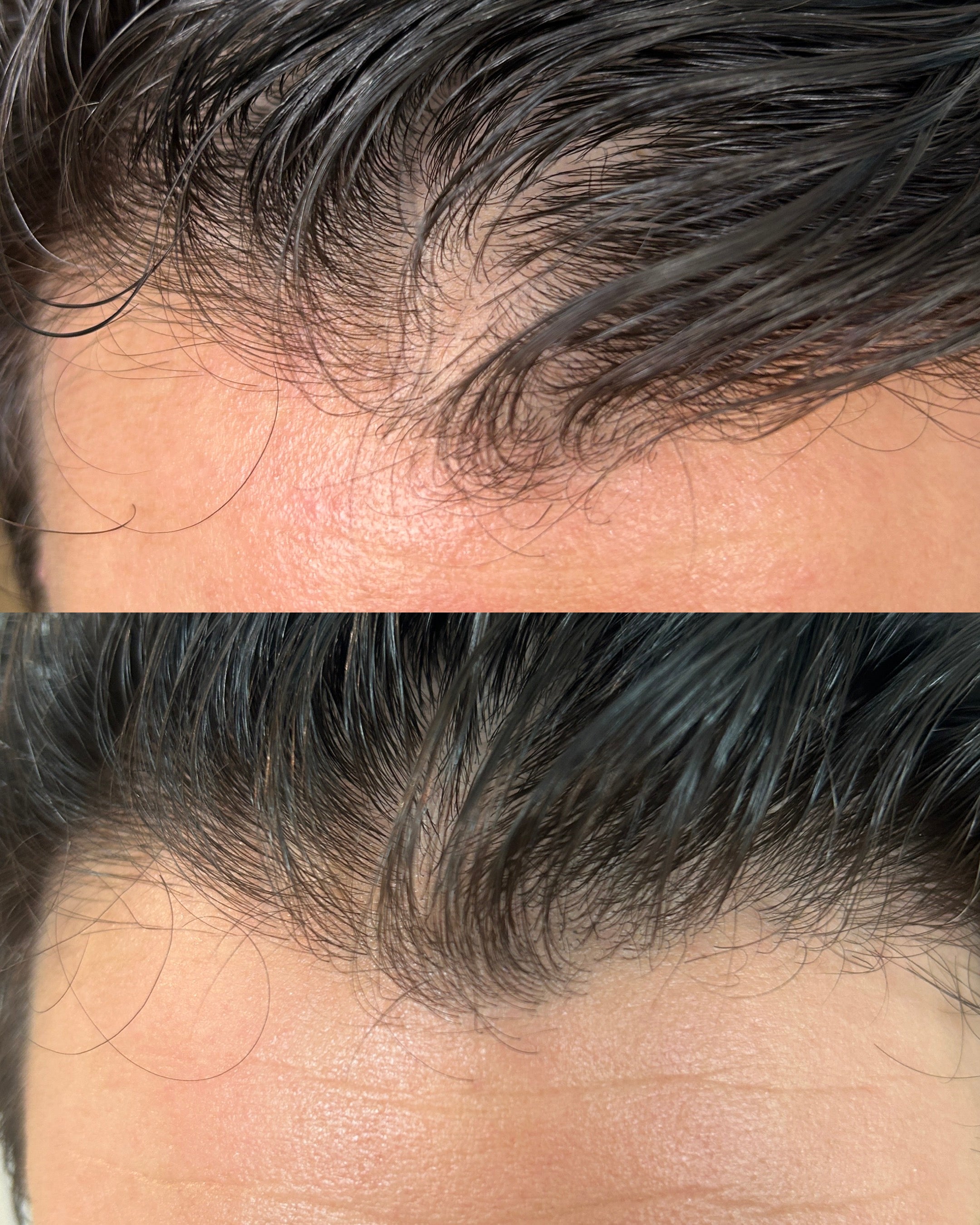 Thrive | healthy hair growth serum