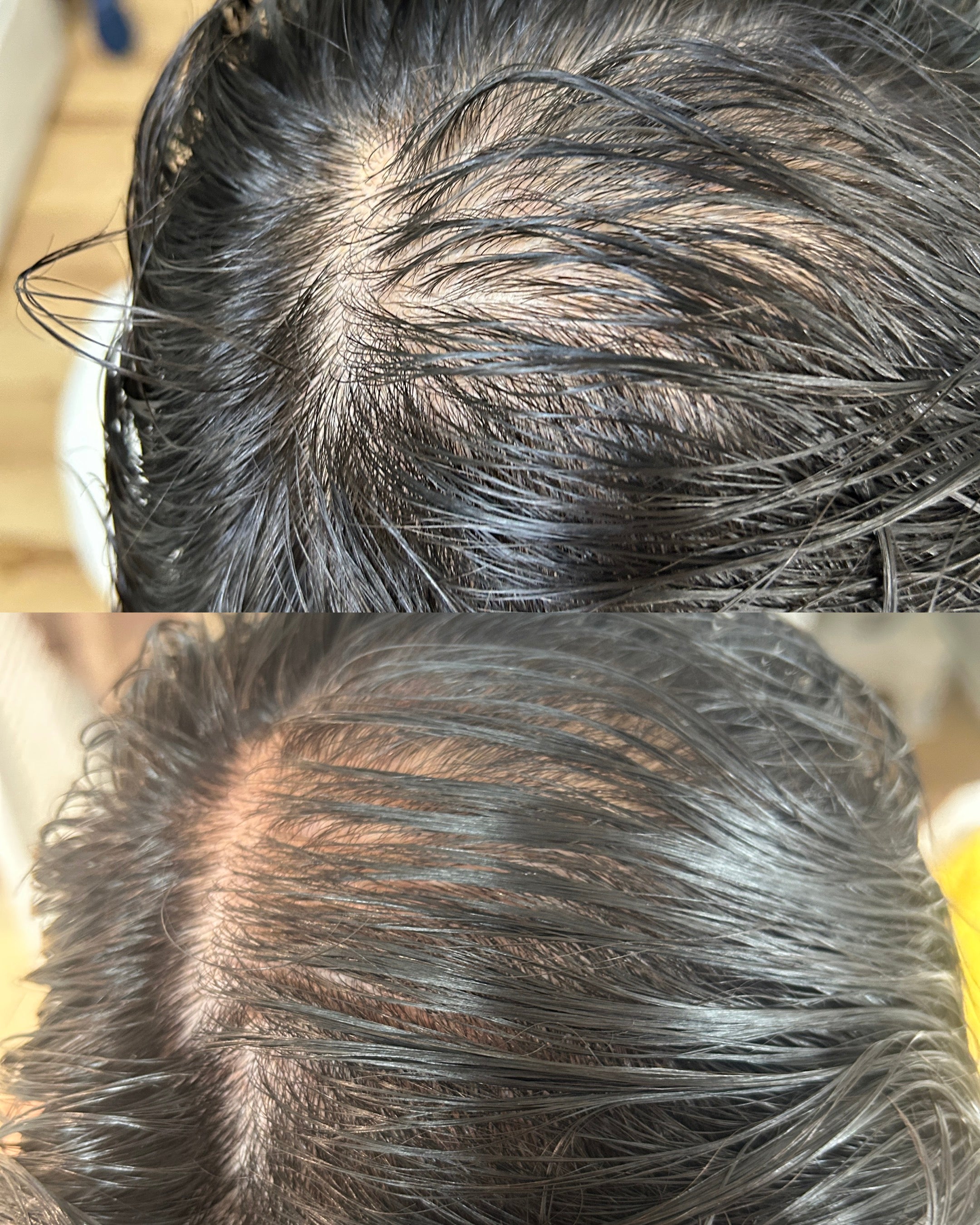 Thrive | healthy hair growth serum