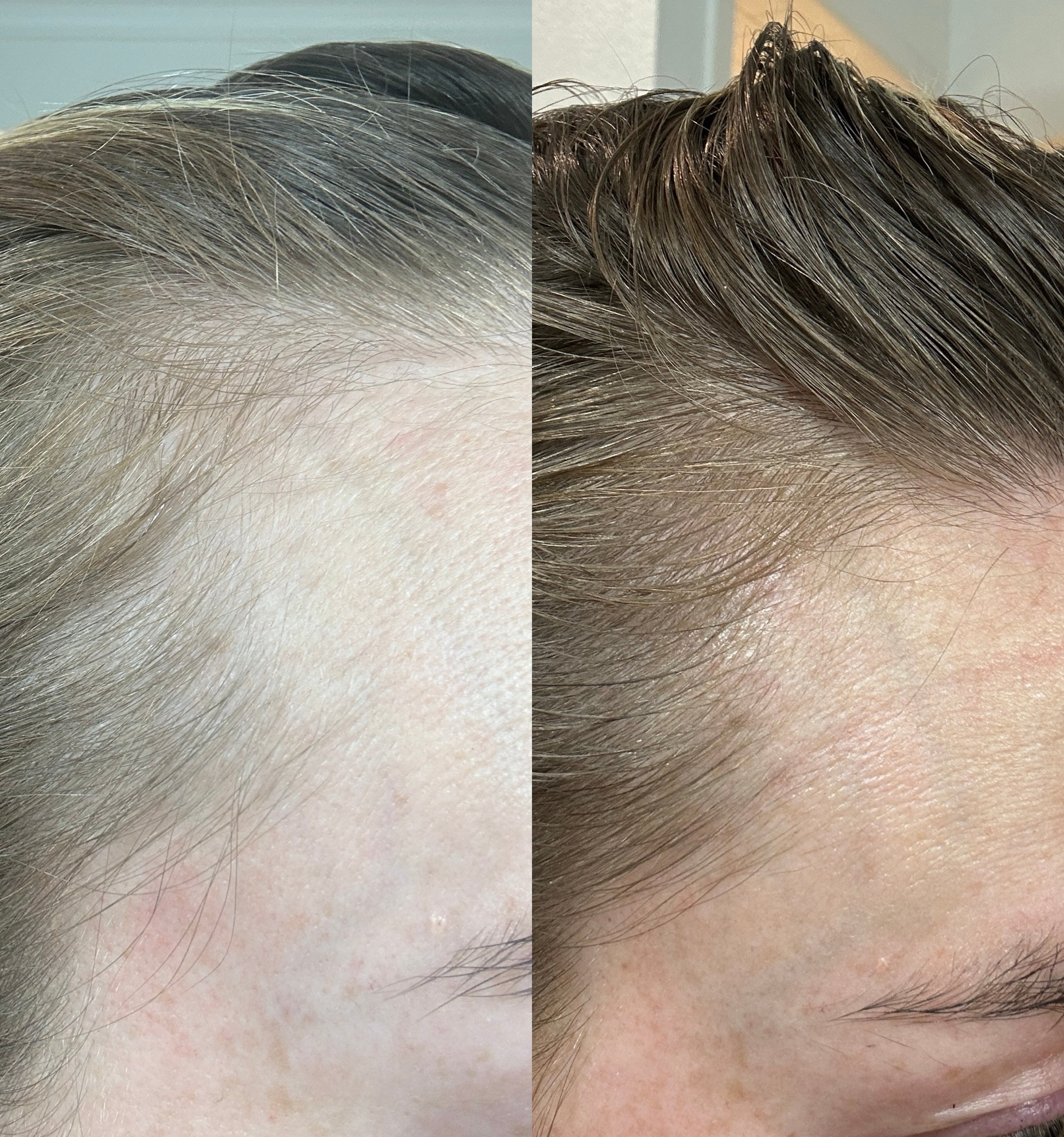 Thrive | healthy hair growth serum