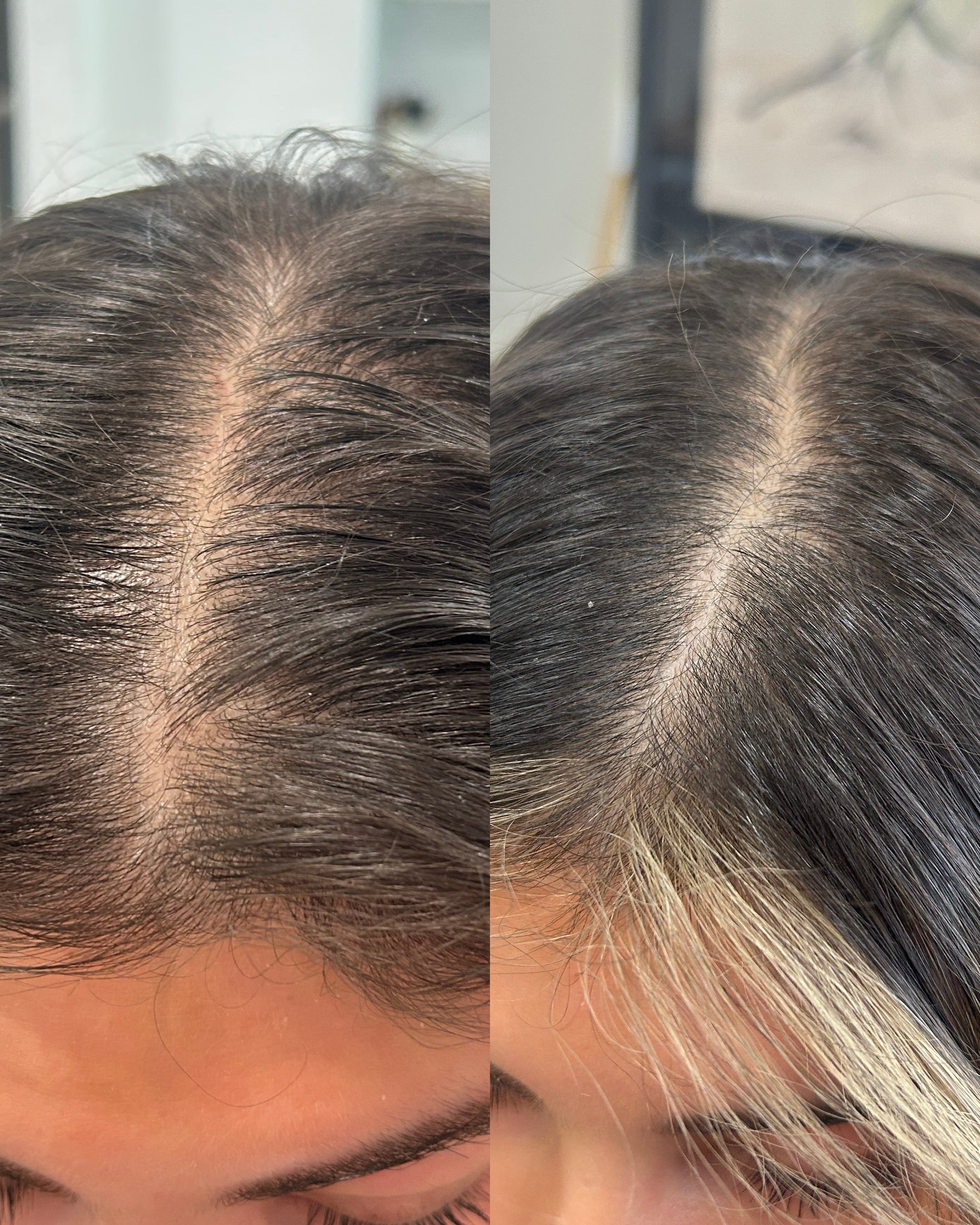 Thrive | healthy hair growth serum